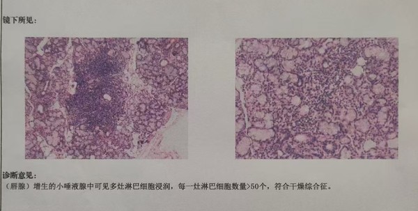 3c6b1051a32f6064c23d8878b28b16a_副本.jpg